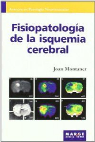 Kniha Fisiopatología de la isquemia cerebral JOAN MONTANER