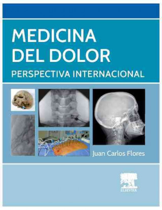 Carte Medicina del dolor: Perspectiva Internacional JUAN CARLOS FLORES
