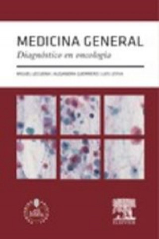 Carte Medicina general. Diagnóstico en oncología Alejandra Guerrero Álvarez