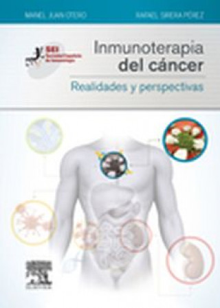 Carte Inmunoterapia del cáncer : realidades y perspectivas M. JUAN
