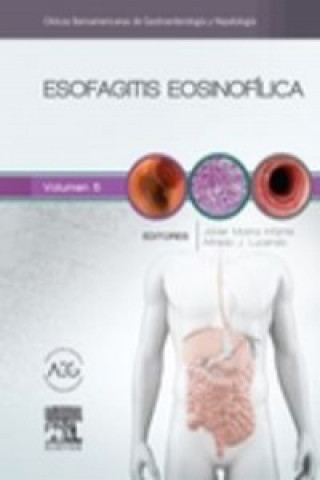 Kniha Esofagitis eosinofílica: clínicas iberoamericanas de gastroenterología y hepatología MOLINA