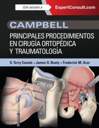 Книга Campbell. Principales procedimientos en cirugía ortopédica y traumatología CAMPBELL