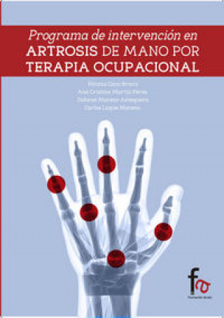 Carte Programa de intervención en artrosis de manos por terapia ocupacional Ana C. Martín Pérez