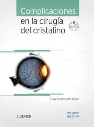Книга Complicaciones en la cirugía del cristalino + acceso web 