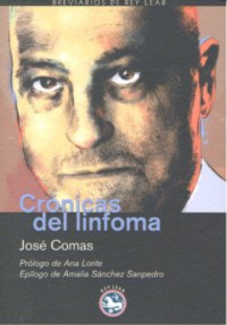 Книга Crónicas del linfoma ; seguido de Cartas al cuerpo místico José Comas Vega