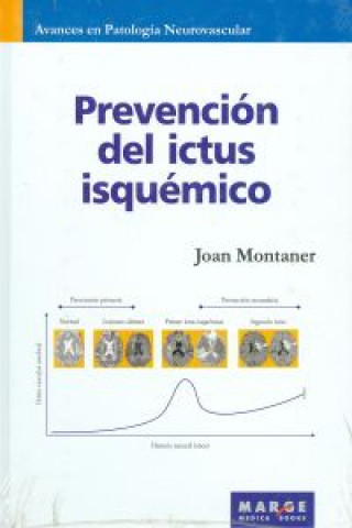 Kniha Prevención del ictus isquémico Joan . . . [et al. ] Montaner Vidal