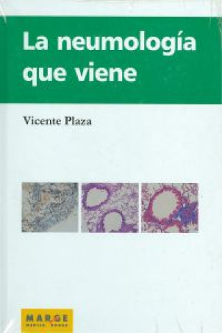 Kniha La neumología que viene Vicente Plaza Moral