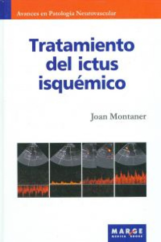 Book Tratamiento de ictus isquémico Joan Montaner Villalonga