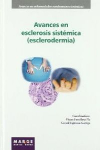 Carte Avances en esclerosis sistémica (esclerodermia) Vicent . . . [et al. ] Fonollosa Pla