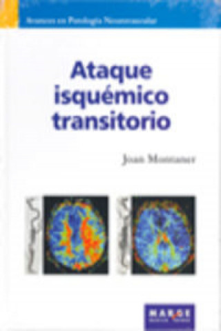 Kniha Ataque isquémico transitorio Joan Montaner Villalonga