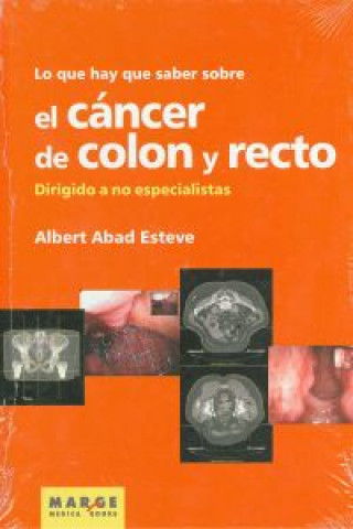 Könyv Lo que hay que saber sobre el cáncer de colon y recto : dirigido a no especialistas Albert . . . [et al. ] Abad Estevez