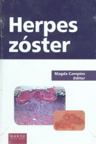 Kniha Herpes zóster Magda . . . [et al. ] Campins Martí