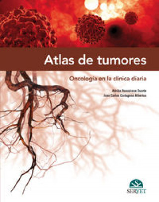 Könyv Atlas de tumores. Oncología en la clínica diaria 