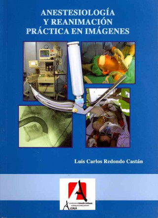 Kniha Anestesia y reanimación práctica en imágenes Luis Carlos Redondo Castán