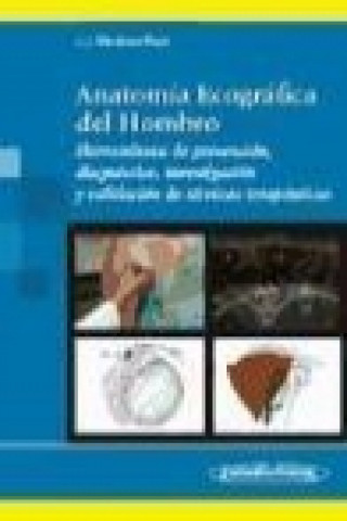 Book Anatomía ecográfica del hombro : herramienta de prevención, diagnóstico, investigación y validación de técnicas terapéuticas Jacinto Javier Martínez Payá