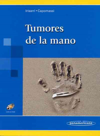 Carte Tumores de la mano Carlos Irisarri Castro