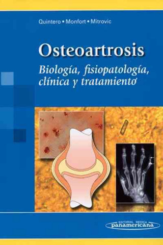 Carte Osteoartrosis : biología, fosopatología, clínica y tratamiento Martza Quintero Monfort