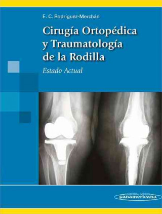 Könyv Cirugía ortopédica y traumatología de la rodilla : estado actual Emérito Carlos Rodríguez Merchán