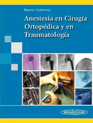 Carte Anestesia en cirugía ortopédica y en traumatología Misericordia Basora Macaya