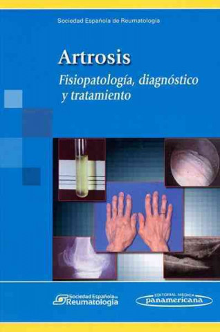 Kniha Artrosis. Fisiopatología, diagnóstico y tratamiento. 
