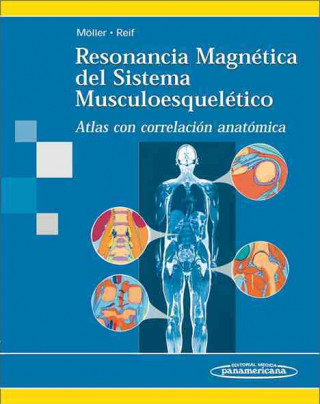 Könyv Resonancia magnética del sistema musculoesquelético : atlas con correlación anatómica Torsten B. Möller
