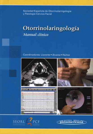 Carte Otorrinolaringología : manual clínico 