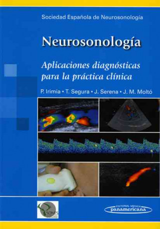 Kniha Neurosonología : aplicaciones diagnósticas para la práctica clínica 