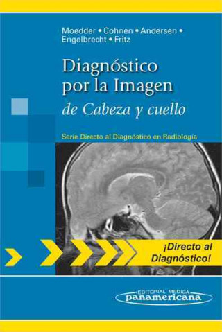 Kniha Diagnóstico por la imagen de cabeza y cuello Ulrich Moeder