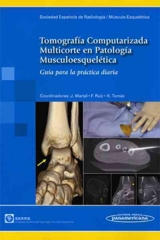 Könyv Tomografía computarizada multicorte en patología musculoesquelética : guía para la práctica diaria 