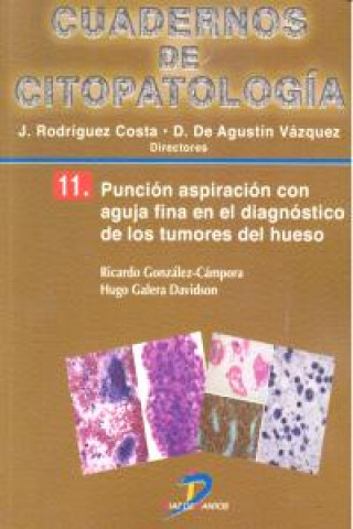 Knjiga Punción aspiración con aguja fina en el diagnóstico de los tumores de hueso 