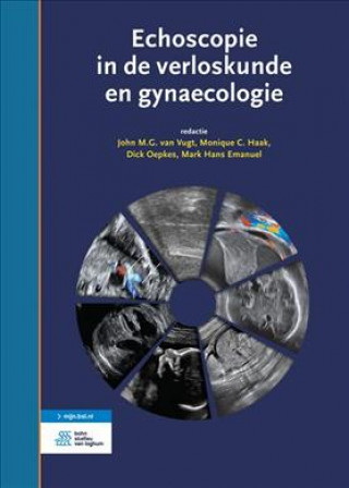 Carte Echoscopie in de Verloskunde En Gynaecologie John M. G. Van Vugt