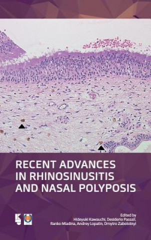 Kniha Recent Advances in Rhinosinusitis and Nasal Polyposis Hideyuki Kawauchi