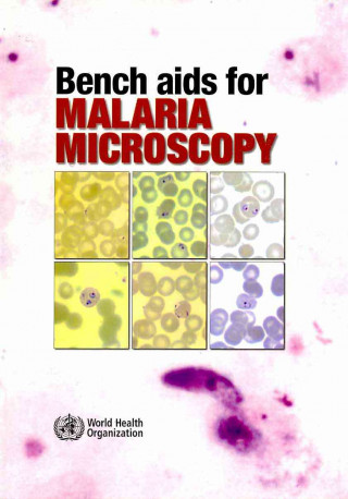 Kniha Bench AIDS for Malaria Microscopy World Health Organization