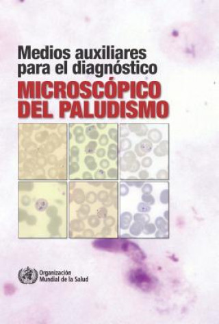 Carte Medios Auxiliares Para El Diagnostico Microscopico del Paludismo World Health Organization