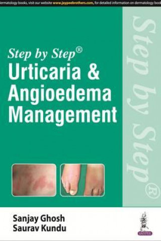 Kniha Step by Step: Urticaria & Angioedema Management Sanjay Ghosh