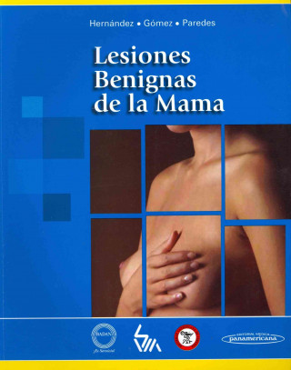 Buch Lesiones benignas de la mama 