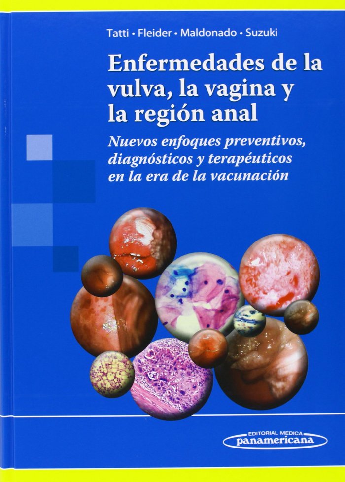 Kniha Enfermedades de la vulva, la vagina y la región anal: Nuevos enfoques preventivos, diagnósticos y terapéuticos en la era de la vacunación 