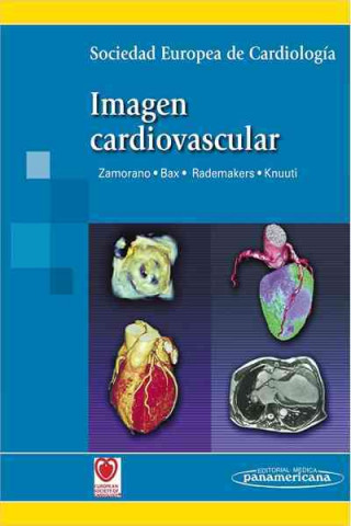 Carte Imagen cardiovascular 