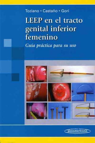 Carte Leep en el Tracto Genital Inferior Femenino. Guía practica para su uso 