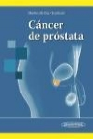Kniha Cáncer de próstata 