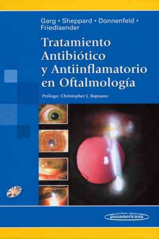 Kniha Tratamiento Antibiótico y Antiinflamatorio en Oftalmología 