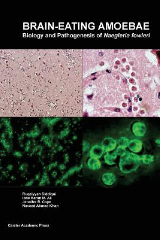 Książka Brain-Eating Amoebae Ibne Karim M. Ali