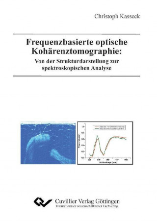 Kniha Frequenzbasierte optische Kohärenztomographie: Von der Strukturdarstellung zur spektroskopischen Analyse Christoph Tobias Kasseck