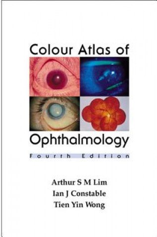 Kniha Colour Atlas of Ophthalmology (4th Edition) Arthur S. M. Lim
