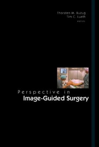 Kniha Perspectives in Image-Guided Surgery - Proceedings of the Scientific Workshop on Medical Robotics, Navigation and Visualization Thorsten M. Buzug