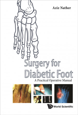 Книга Surgery For Diabetic Foot: A Practical Operative Manual Abdul Aziz Nather