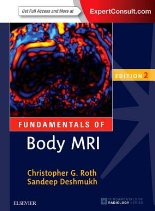 Książka Fundamentals of Body MRI Christopher G. Roth