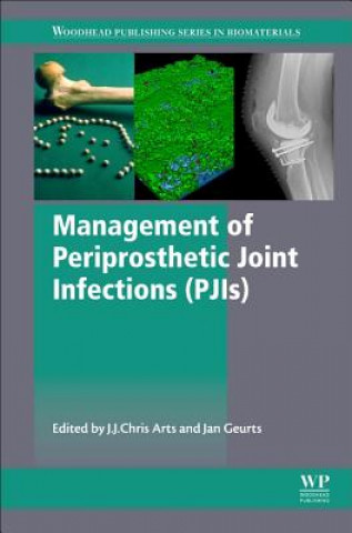 Carte Management of Periprosthetic Joint Infections (PJIs) Chris  J. Arts