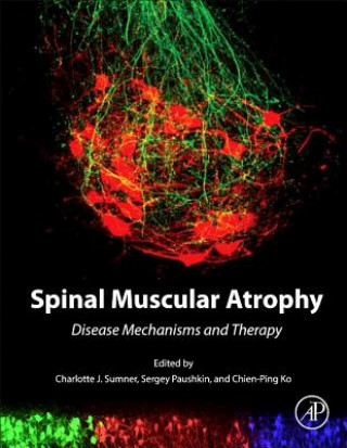 Könyv Spinal Muscular Atrophy Charlotte J. Sumner