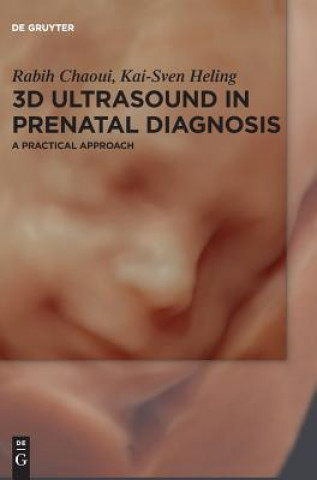 Kniha 3D Ultrasound in Prenatal Diagnosis Rabih Chaoui
